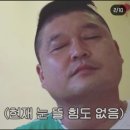 YES안경 | [일상] 투데이라섹 수술 3개월 차 후기글 | 강남 안과 | 눈 검진부터 수술까지