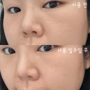 서화01 | 모공역주행세럼으로 유명한 &#39;희올 모공탄력 세럼&#39; 일주일 사용후기