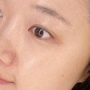 송파 에스테틱 물방울 LDM관리 루미나에스테틱