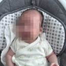 35-D | [육아일기 D+57일] BCG접종 35일경과 귀 교정기 적용후기