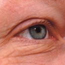 보스안과의원 이미지