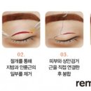 바로메드 이미지