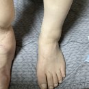 20235544 김민주 의안과제(2) 이미지