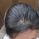 에이바헤어 금천시흥점 | 금천구청역 미용실 염색 후기] 에이바헤어