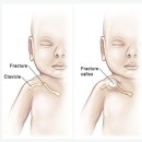 자연주의약국 | 햇빛병원 자연분만 VIP실 2박3일 입원 후기