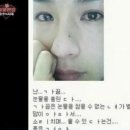 멍브로 이미지