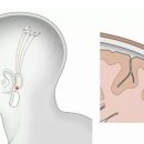 일론 머스크 올해말 인간대상 뉴럴링크 임상실험 전망 이미지