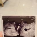 덕천지소 화장실 | 부산북구보건소 덕천보건지소 엽산받기(임신4-5주차 증상, 갈색혈, 입덧시작)