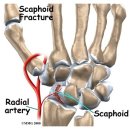 손목 MRI (Wrist MRI) 영상진단 이미지