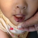 지니성형외과의원 이미지