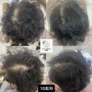 도노포레스타 두피케어(산본점)