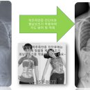 선메디칼(주) 네이버블로그