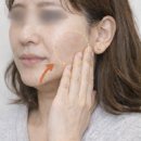 온누리피부과의원 | 청주 피부과 텐써마 리프팅 고현정되고싶은 30대 후반 여성 후기