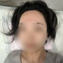 뷔에고 | 이태원 헤어라인 이마 구렛나루 왁싱 후기, 뷔쥬아왁싱