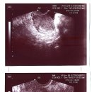 민유선산부인과의원 티스토리