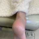 레푸스원주점 | 원주내성발톱 레푸스 원주점 발각질 후기