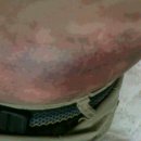 고경석한의원 Daum카페