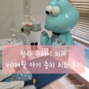 청라 꾸러기치과 아기 충치 치료 후기 (GI, 웃음가스) 및 주차 정보