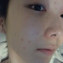 J6176 | 낫츠 28레미디 라인 후기