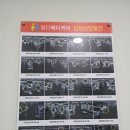 첨단메디케어의원 | 갑상선암 전절제 수술 후 4년차 초음파검사! 전공의파업 이슈ㅜㅜ