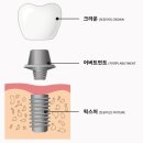 한결치과기공소 이미지