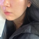 간판미인 | [청주 윤곽 관리] 청주대학교 근처 경락 / 후광미인 / 후기사진