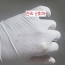 이피온드스킨