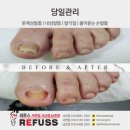 레푸스사상점
