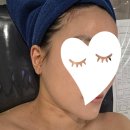 명의약초 | 광교피부관리 '달리아에스테틱 광교중앙역점'에서 작은얼굴 윤곽관리 받고 온 100% 솔직 후기