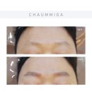 강동-천호-2429 | 눈썹전문 반영구제거 붉은눈썹 쉐도우눈썹 피코토닝 뷰러펌 잠실 송파 위례 장지 강동 천호 건대 동대문