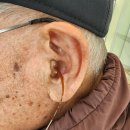 대동 독일보청기 이미지