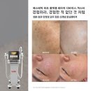 엑스터
