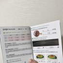 바른눈안과의원 | 눈에미소안과의원 스마일프로 후기