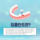 선사치과기공소 | 안산치과병원, 선택한 수면임플란트 후기