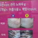 나영테라피 네이버블로그