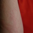 화곡부부한의원 이미지