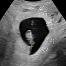 르샘여성의원 이미지