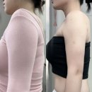 오렌지 뷰티케어 | 팔뚝 무한람스 팔뚝살주사 오렌지케어 4주차 전후 비교 후기 Q&A까지