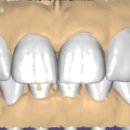 서현치과기공소 이미지