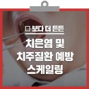 올해 가기전에 건보해택 놓치지 말고 스케일링 받으세요 이미지