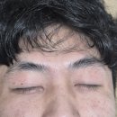 디플러스 | 샤블 디플러스 크림 내돈내산 후기(붉은자국,민감성,아토피)