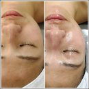 씨유대전유천스타점 | 212네일 뷰티&amp;스킨 스타리프팅으로 꿀피부 되고 온 후기