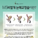 풀림 이미지
