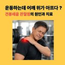 바로척마취통증의학과의원 | 푸시업, 숄더프레스하다 어깨 위가 아프다면? 어깨 통증의 숨은 원인 [견봉쇄골관절염]