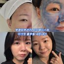 (주)아크 | 부평피부관리 브이메디스파 아크핏 블루필 내돈내산 후기(주차정보)