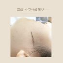 미랑뷰티 네이버블로그