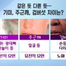 잠실미소약국 네이버블로그