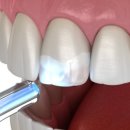 연세홈치과의원 이미지