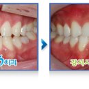 나무치과기공소 이미지