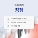 감동e플란트치과의원 | 주안역치과 임플란트 전 알아두면 좋은 정보들